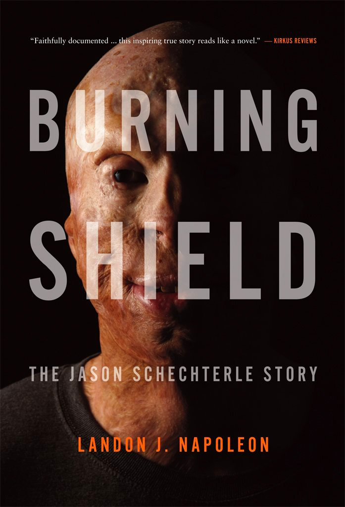 Burning Shield Cover Jason Schechterle